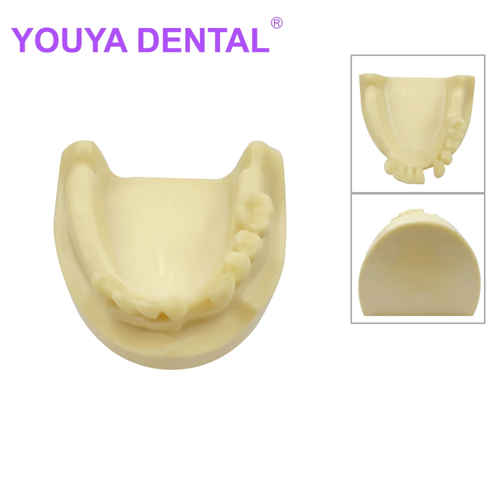 

Dental Implant Practice Model Lower Jaw Model With Missing Teeth Dentist Teaching Tool Models Dentistry Education Demonstration