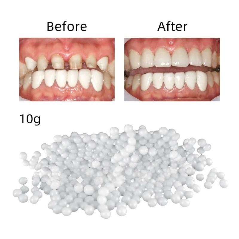 10/100g Temporary Tooth Repair Beads Missing Broken Teeth Dental Tooth Filling Material Food Grade FalseTeeth Solid Glue Denture