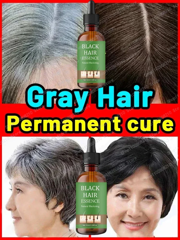 Grey Coverage Bar Shampoo Repair Gray Natural Anti-Grey Hair Essence Serum Smoothing Nourishing Dandruff Natural Darkening Soap