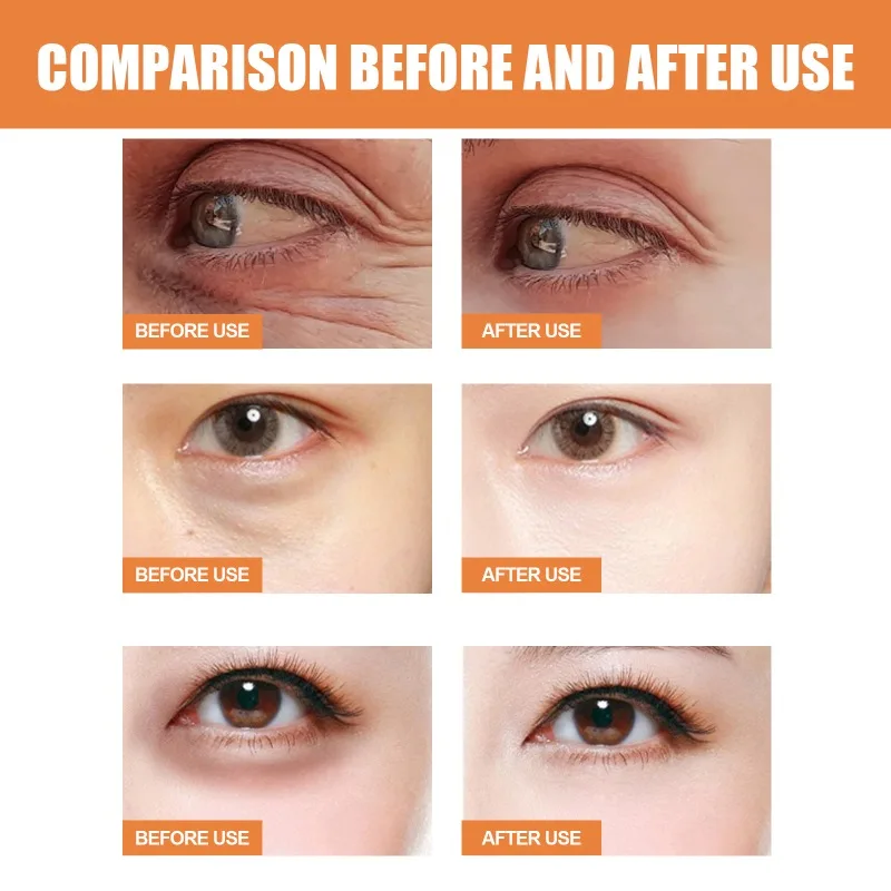 Vitamin C Augen creme Stick verblassen feine Linien Anti Augenringe Augen taschen Schwellungen aufhellen feuchtigkeit spendende Augen Kontur Hautpflege