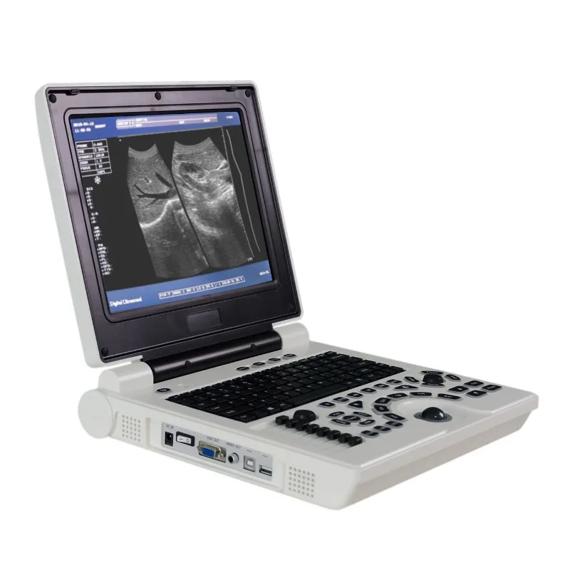 

Veterinary Medical Ultrasound Instruments Portable Full Digital Sheep Canine Dog Pig Ultrasound Machine Animal Care and Supplies