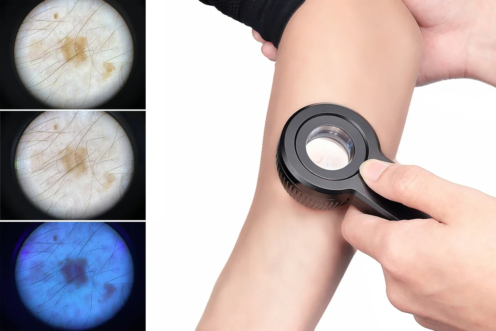 IBOOLO جودة عالية 365nm ضوء الأشعة فوق البنفسجية DE-3100 PRO منظار الجلد المستقطب للبشرة صحي2025