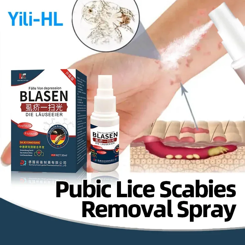 

Pubic Lice Scabies Removal Spray Mites Head Lice Eggs Treatment Remover Antibacterial Anti-Itching German Secret Recipe Medicine