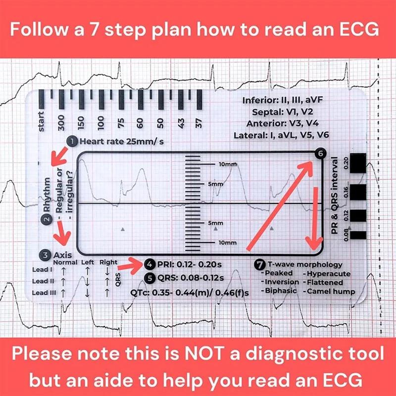 ECG 7 Step Ruler, ECG 7 Step Ruler For ECG/EKG Interpretation, Rapid And Quick Cardiac Analysis And Measurement Tool