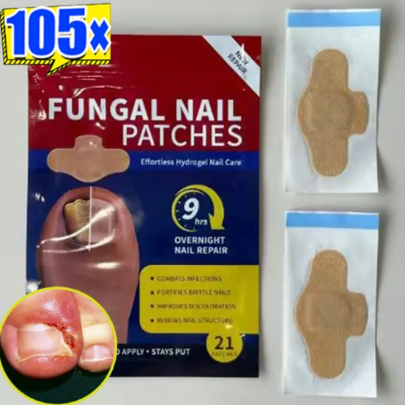 21/105Pcs Super-effective Nail Repair Patches 9hours Persistent Efficacy Paronychia Toenail Care Nail Ingrown Correction Sticker