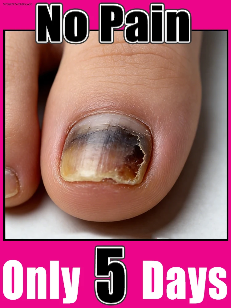 

Ваканционные распродажи, инструменты для маникюра, средства для чистки ногтей