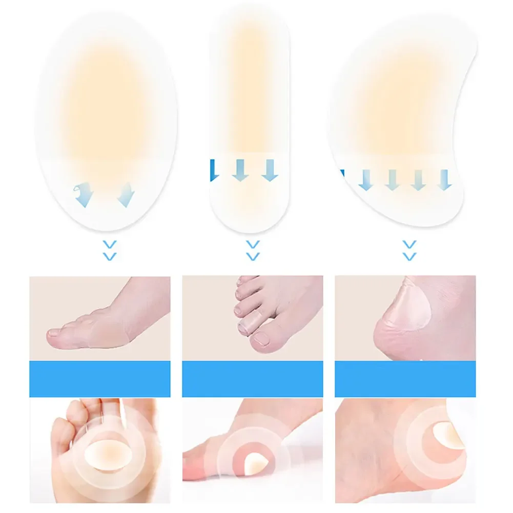 20 قطعة هلام لينة عالية الكعب القدم بقع لاصق كعب نفطة ضمادة الأحذية الغروانية المائية ملصقات لتخفيف الآلام الجص العناية بالقدم