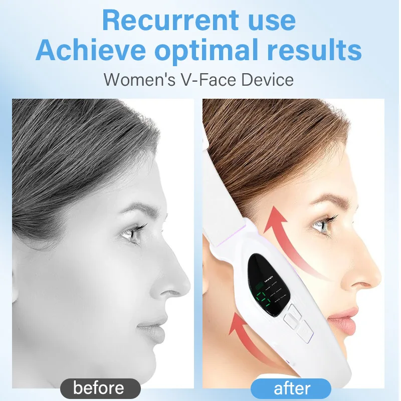 Masajeador facial en forma de V, dispositivo de belleza con modo de hidromasaje, Control remoto, fotones LED, instrumento de Estiramiento facial, eliminación de papada