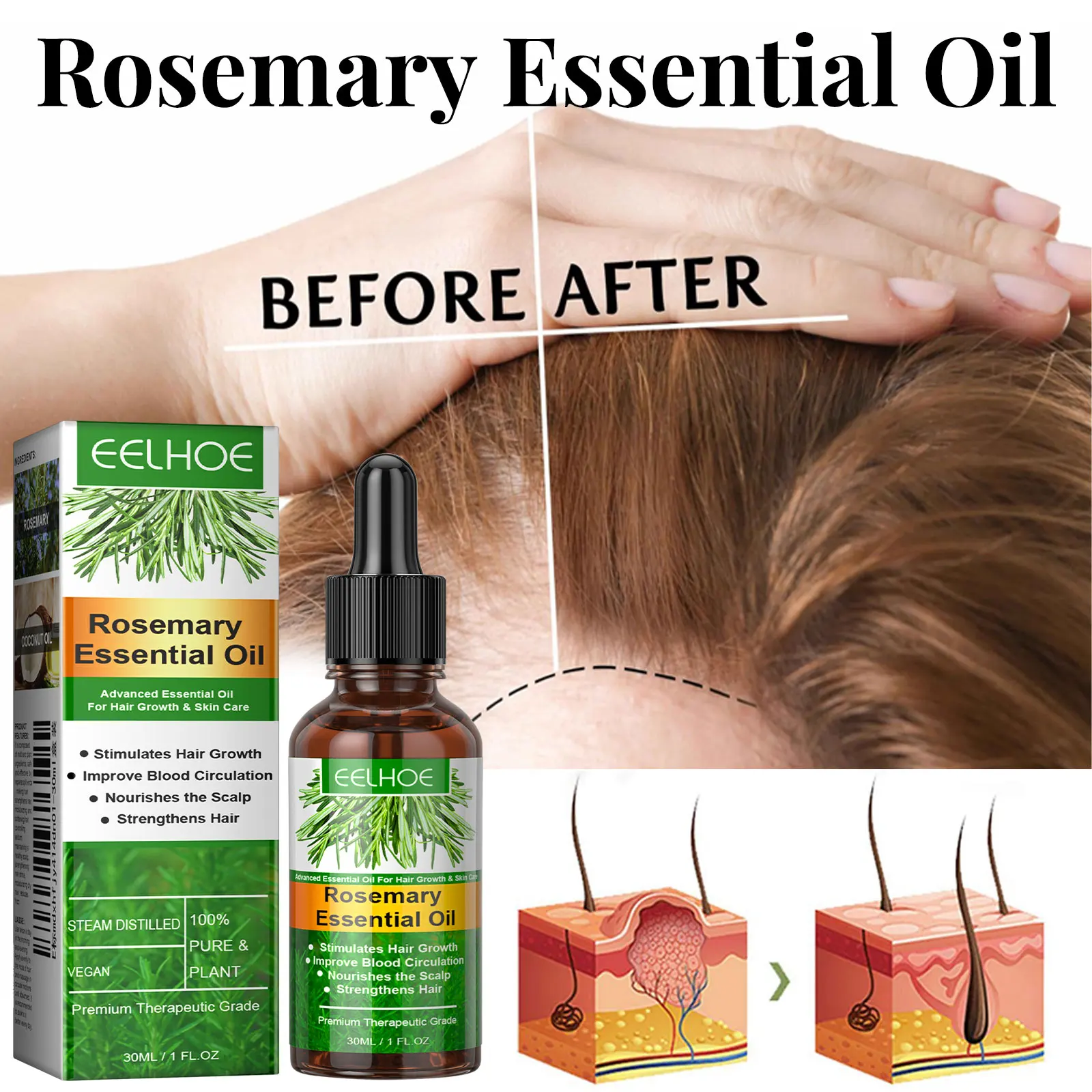 Rosemary Hair Care Essential Oil Nourishes The Scalp Prevents Hair Loss Strengthens Hair Roots Natural Organic Hair Care Product