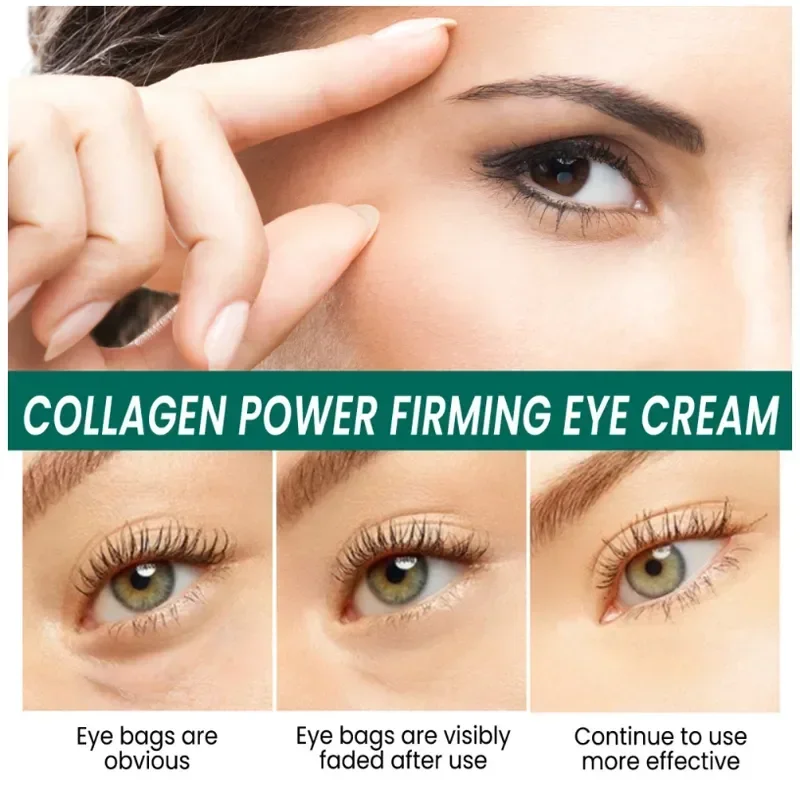 Crema para los ojos antiojeras, bolsas para eliminar las arrugas instantáneas, hinchazón, desvanecimiento, línea fina, tensar, blanquear, cuidado de los ojos