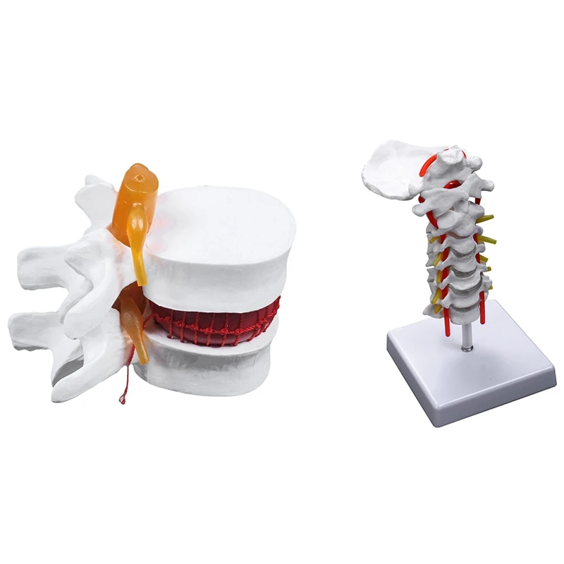 1 Pcs Human Anatomy Skeleton Spine Lumbar Disc Teaching Model & 1 Pcs Cervical Vertebra Arteria Spine Nerves Model