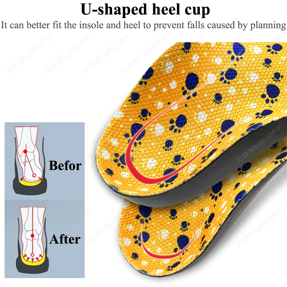 Picture 6: Kids Flatfoot Orthopedic Sport Insoles for Shoes Children Orthotics Insoles Flat Feet O/X Leg Correction Arch Support Shoe Pad
