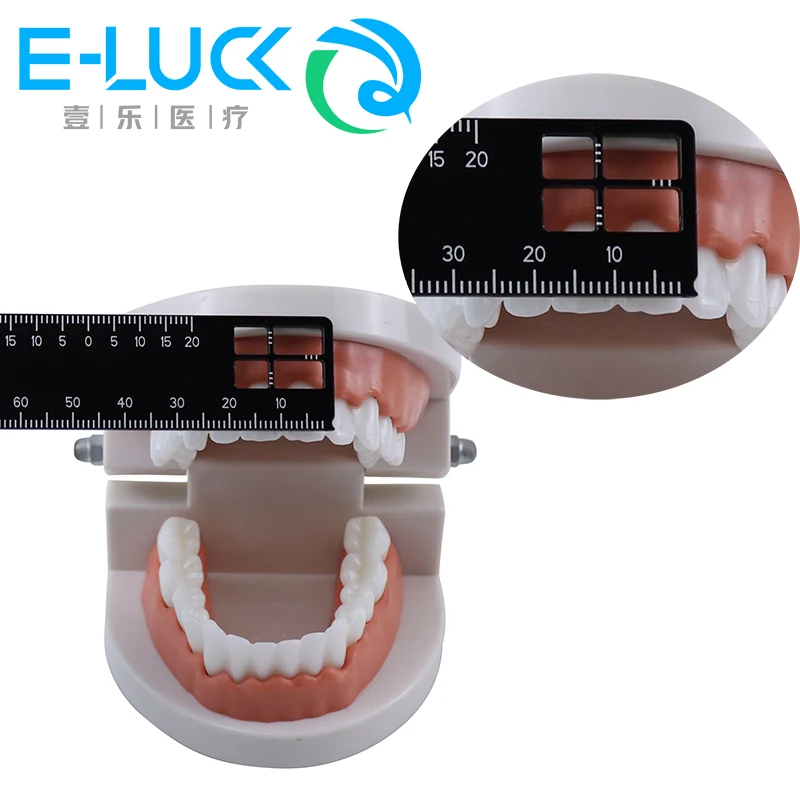 Régua de medição de precisão dental ferramenta médica extensão medida escala instrumentos endodontic odontologia