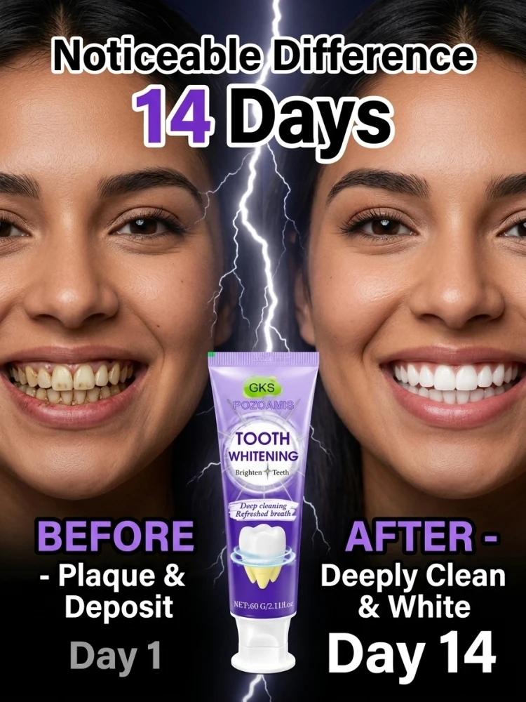 Pasta de dientes blanqueadora para uso doméstico, con una fórmula suave que elimina las manchas superficiales y la placa dental, refresca la boca y ayuda a mantener los dientes limpios y con un aspecto brillante en el cuidado bucal diario.