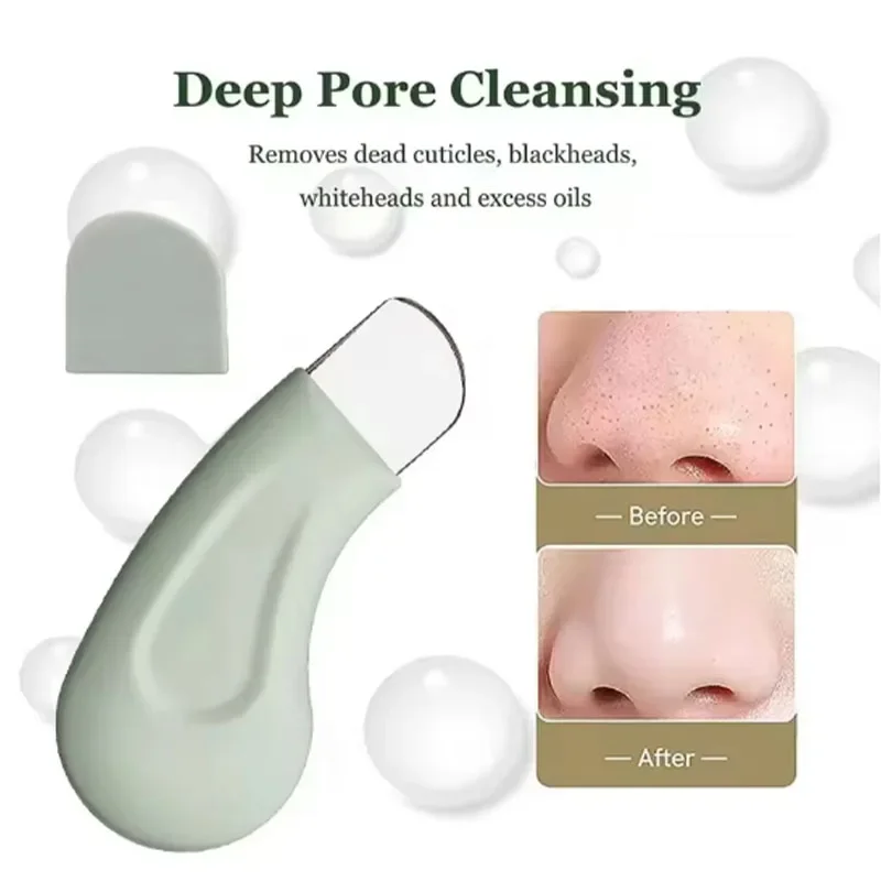 1pcs Blackhead and Whitehead Removal Tool for Nose and Face - Ergonomic Blackhead Remover Spatula - Manual Facial Skin Scrubber