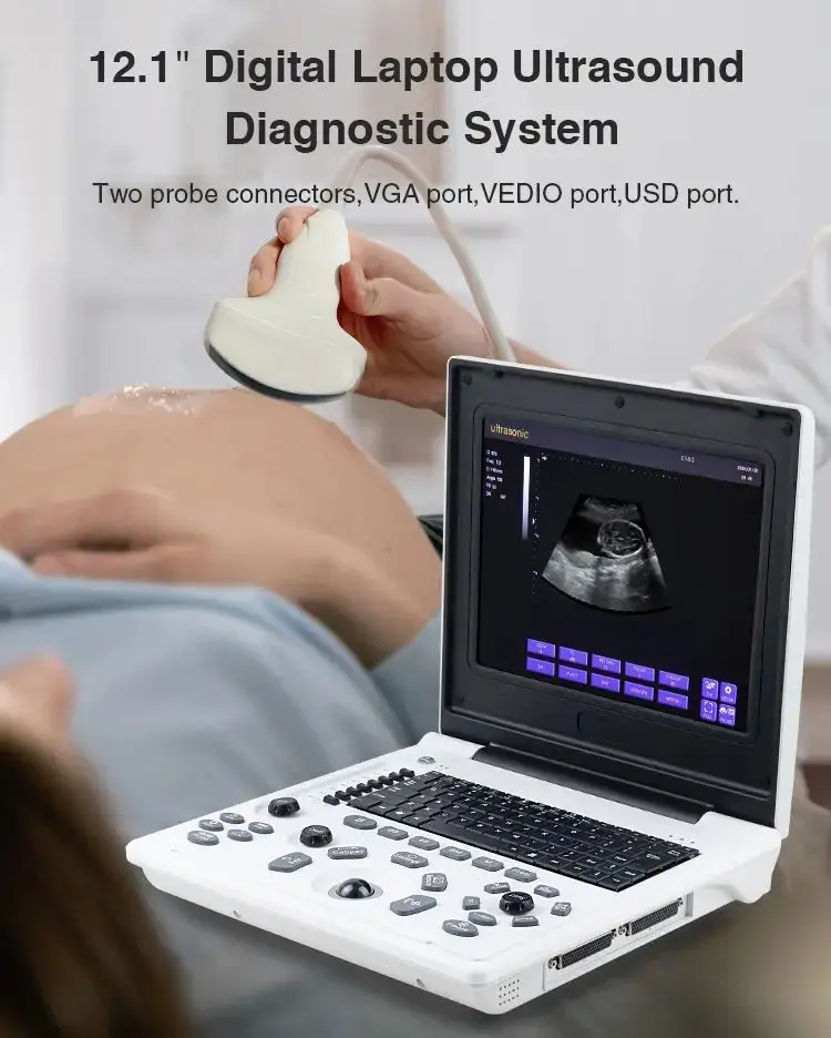 portable medical digital echocardiography instruments sonography ultrasonography laptop black and white  ultrasound Scanner USG