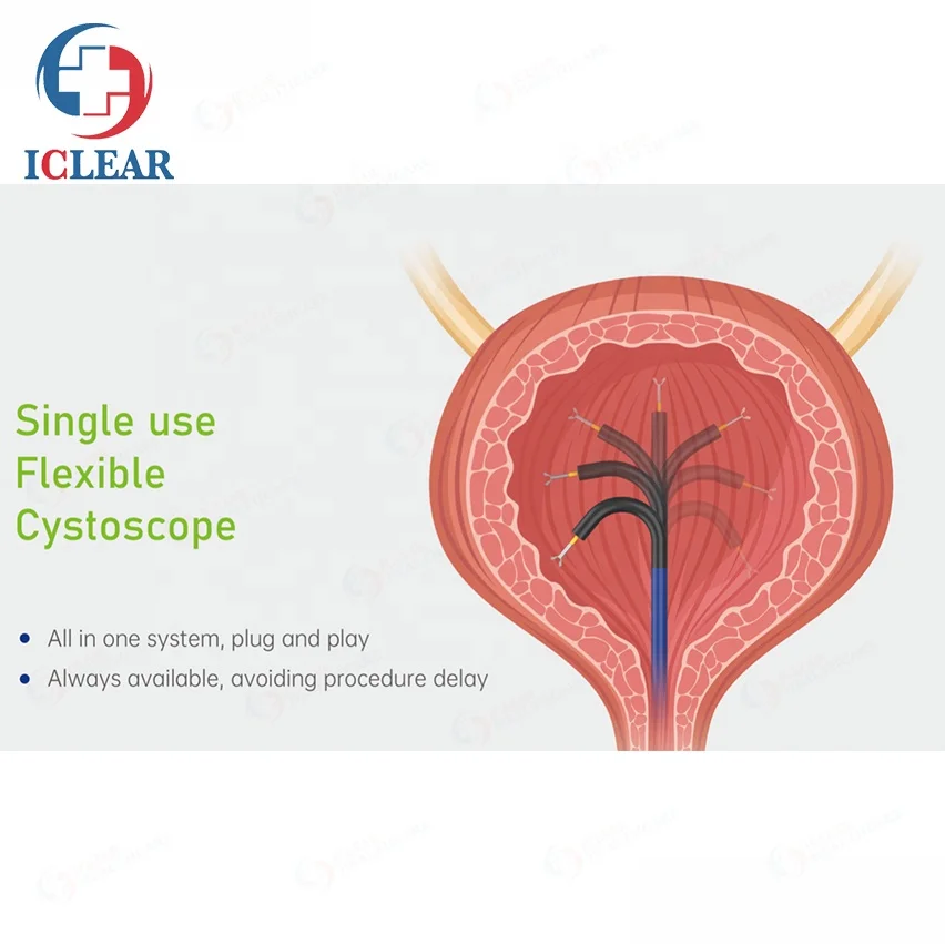 Imagem -05 - Endoscópio Descartável Milhões de Pixel Portátil Único-uso Vídeo Cystoscope Flexível com Monitor