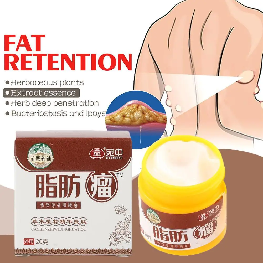 20G Lipoma Removal Cream The Whole Body Multiple Subcutaneous Conditioning Cream Eliminate Tumor Removal Ointment