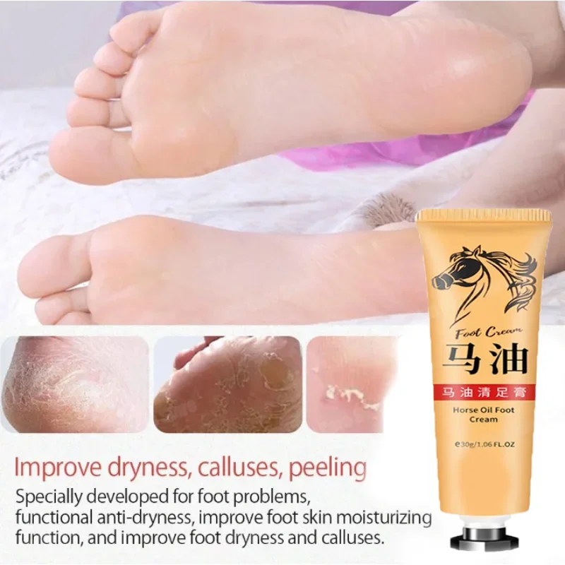 Horse Oil Skin Cream Anti-cracking Ointment Prevents Dry Skin Moisturizes Protects Fingers Feet And Skin Care Products