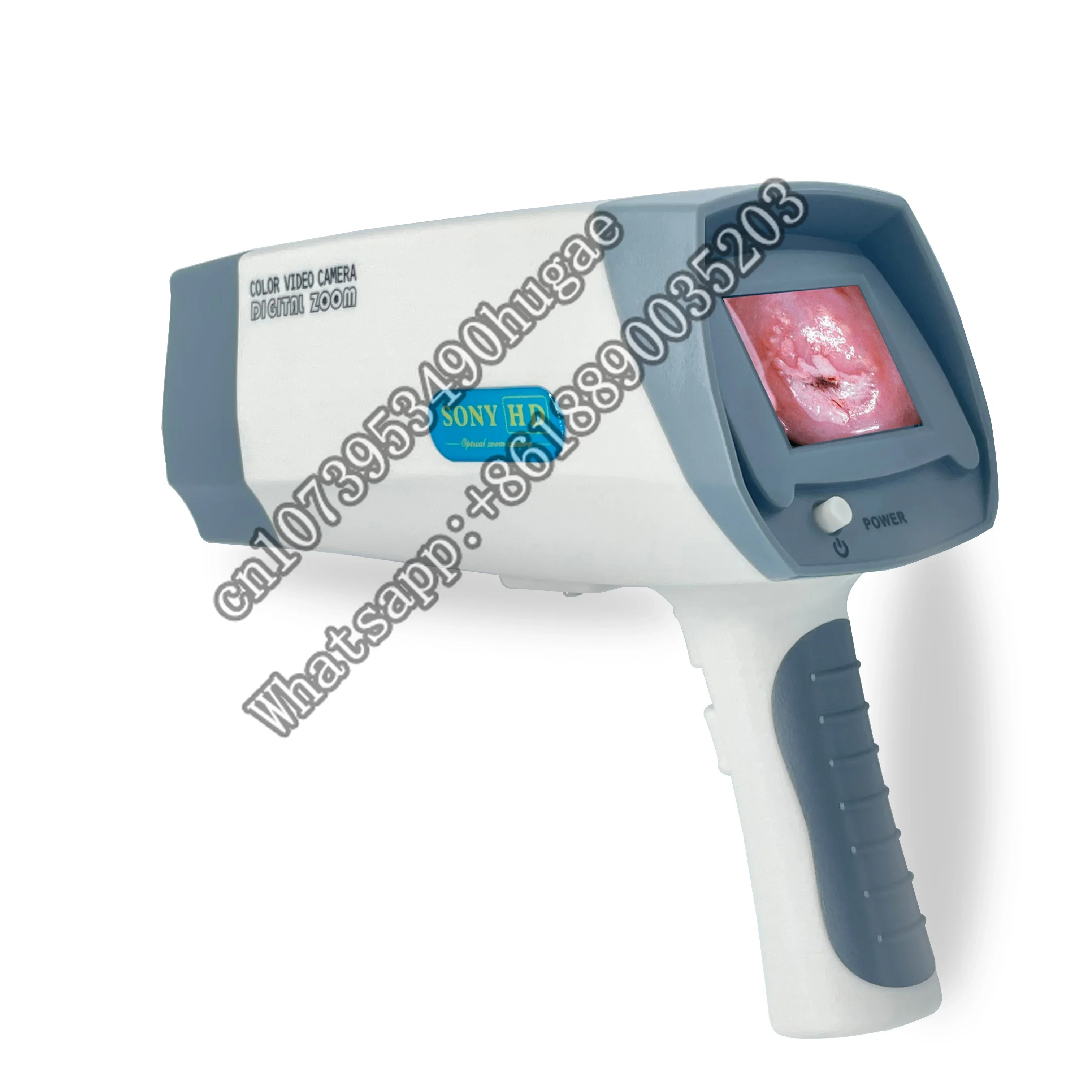 Best Selling Portable Gynecology Endo--scope with Digital Display Screen and Software