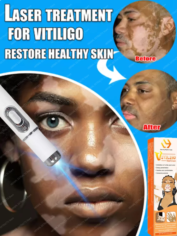 

Efficient laser technology to quickly improve vitiligo