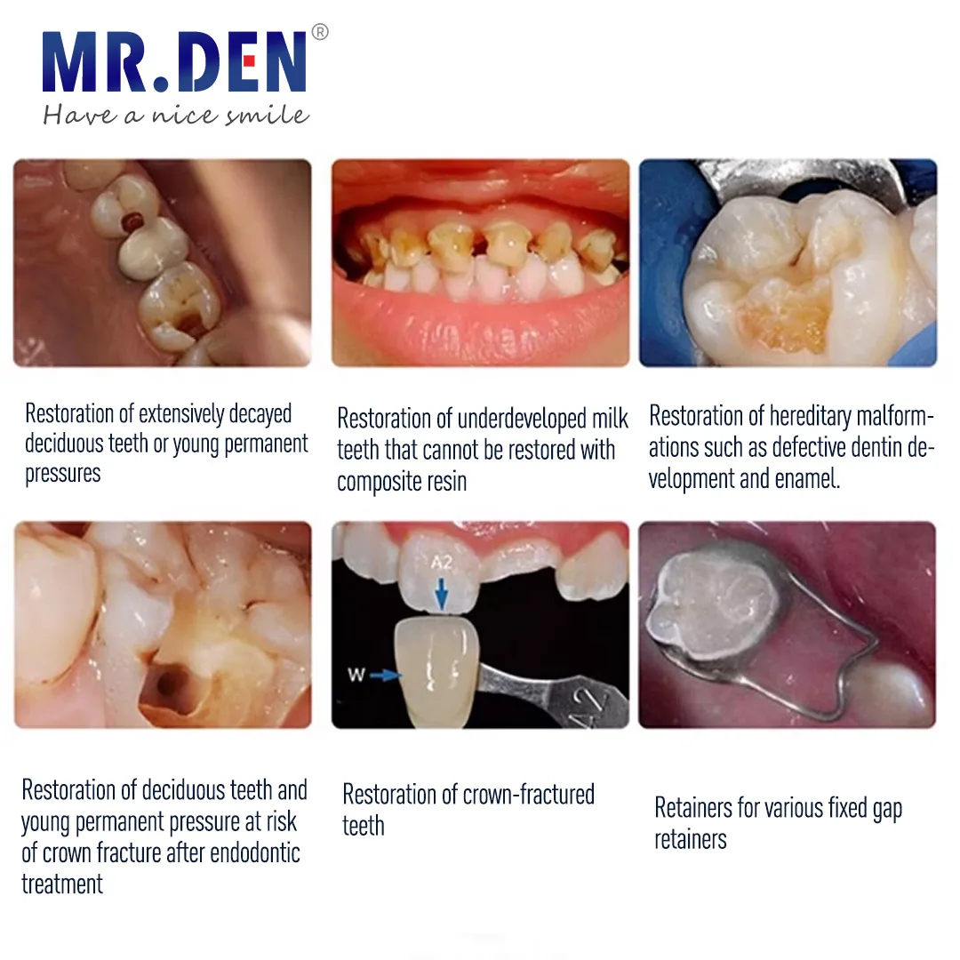 Materiał dentystyczny 3M do karmienia piersią wstępnie uformowane korony ze stali nierdzewnej 2 sztuk/pudło pierwszego zęba trzonowego