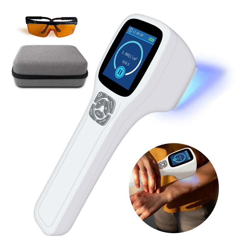 Skin Diseases Treatment Equipment 308nm UV Light Phototherapy Device Uvb Light Therapy for Vitiligo Psoriasis Eczema 40mW/cm2