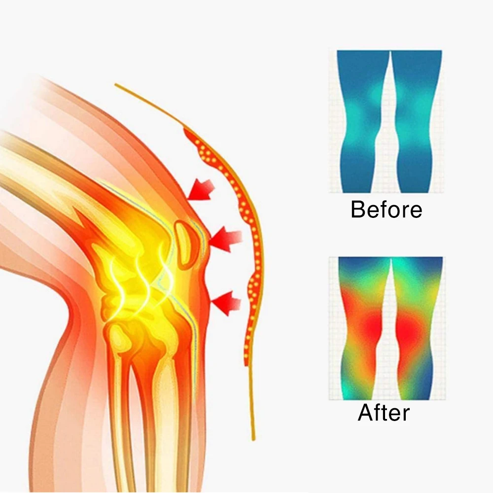 Turmalin samonagrzewający się orteza stawu kolanowego wsparcie 8. terapia magnetyczna nakolanniki zapalenie stawów ulga w bólu zapalenie stawów