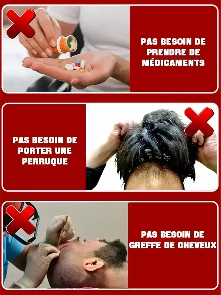 2025 biotina óleo de crescimento rápido do cabelo soro de recrescimento do cabelo tratamento de desbaste do cabelo líquido de crescimento do cabelo anti-perda de cabelo para mulheres e homens
