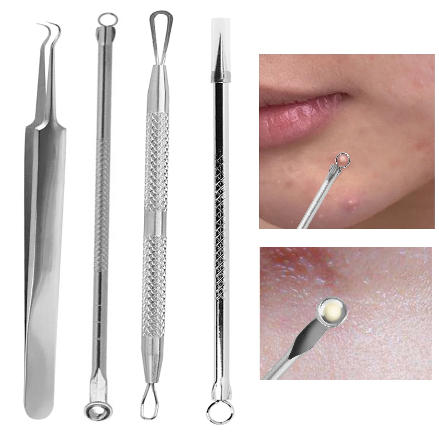 Stainless Steel Acne Blackhead Removal Needles Black Dots Cleaner Black Head Pore Cleaner Deep Cleansing Tool Skin Care Tools