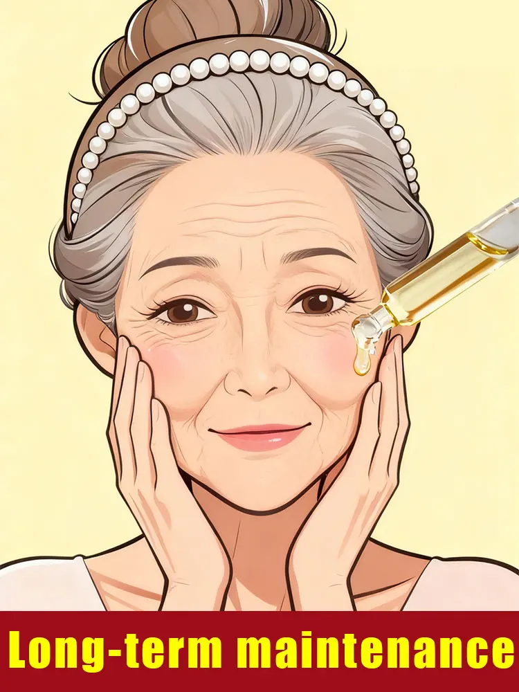 

Нет мелких линий 20-летний младший