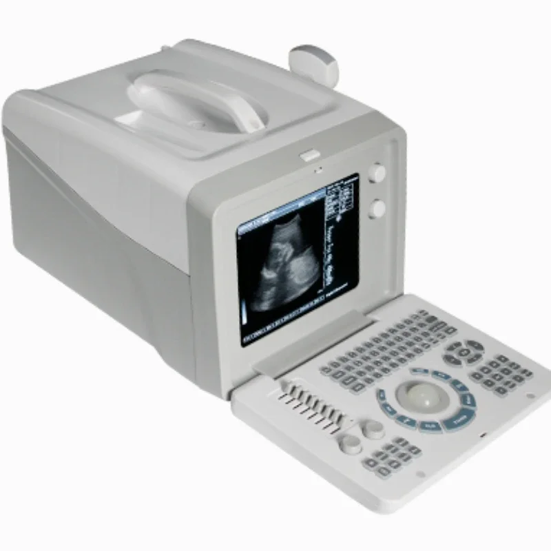 SS-5 portable B-ultrasound color