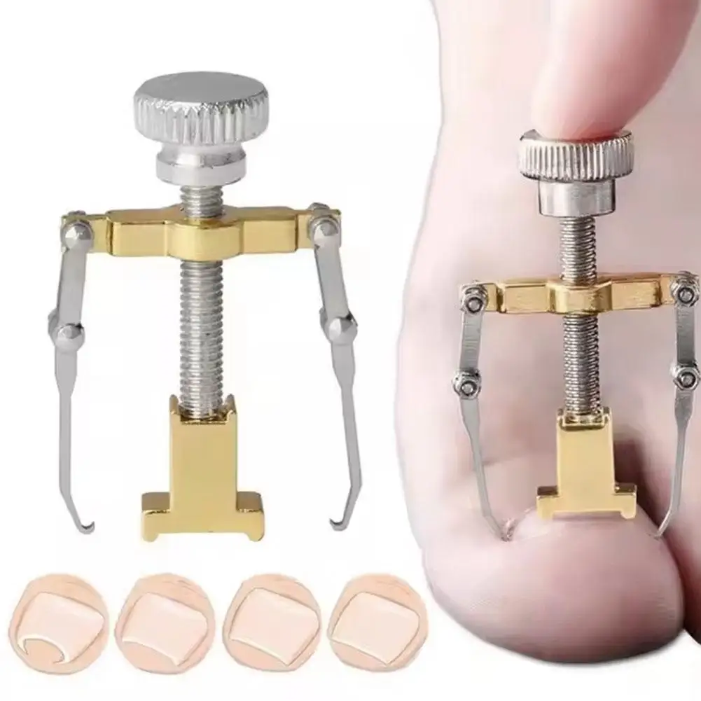 Corretor de unha encravada, clipe de alisamento, tratamento de pedicure, ferramentas de aço, correção de pedicure, cuidados com onyxis, mancha de pé d3u6