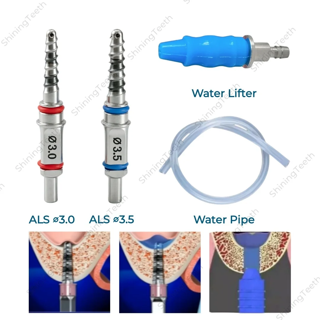 Dental Als Sinus Li…