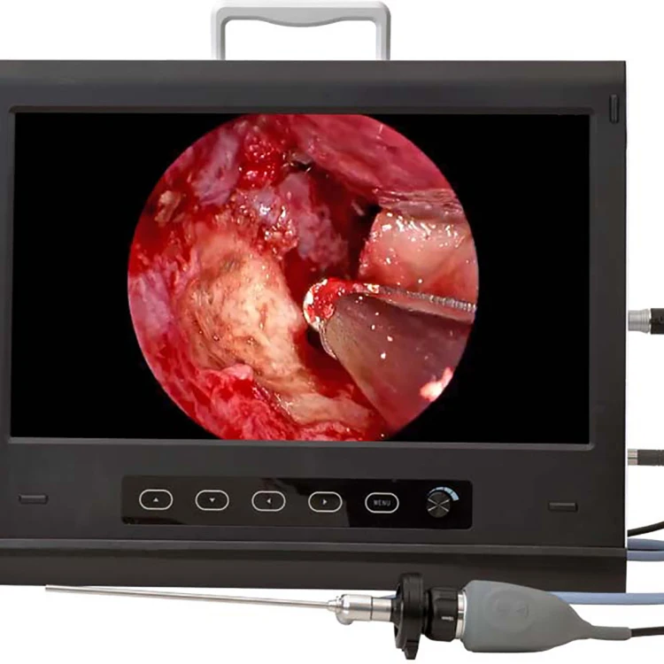 MSLED09 Latest Portable 19/22 Inch Display Full HD Medical Endoscope Camera With Sinuscope Otoscope Laryngoscope Larparoscope