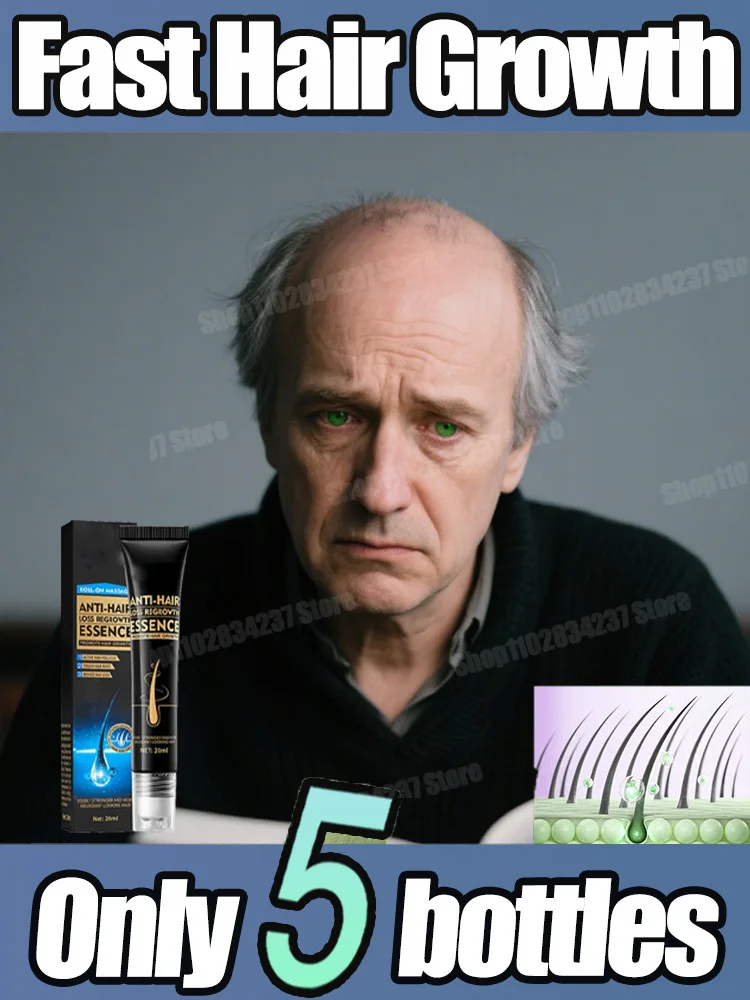 

Восстанавливающая сыворотка для волос с имбирным маслом для предотвращения выпадения волос, ухода за кожей головы, укрепление корней, усилитель роста