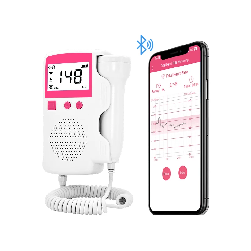 ホットセール医療用超音波機器高感度調整可能3mhzリアルタイム胎児心拍数（胎児心拍数）アプリ付き
