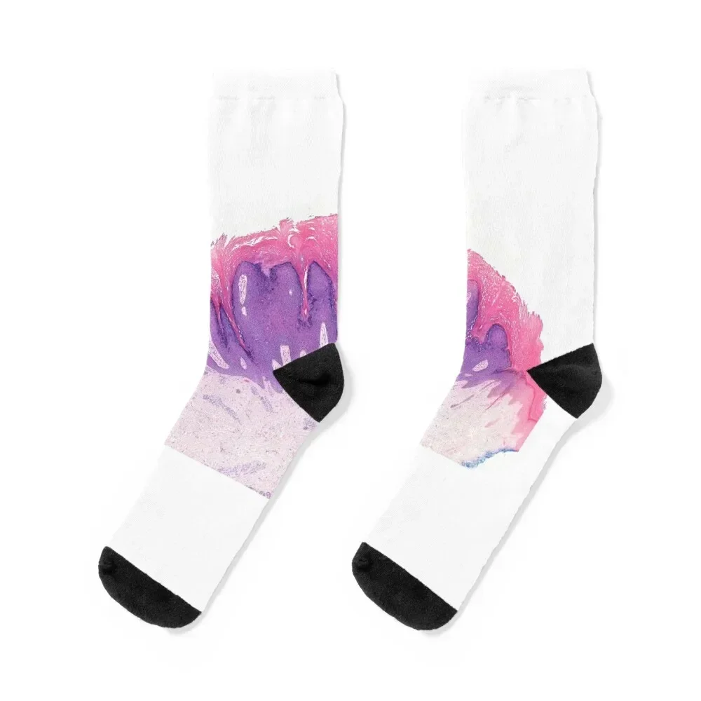 

Skin wart, light micrograph (C024/8119) Socks aesthetic professional running Socks Men's Women's