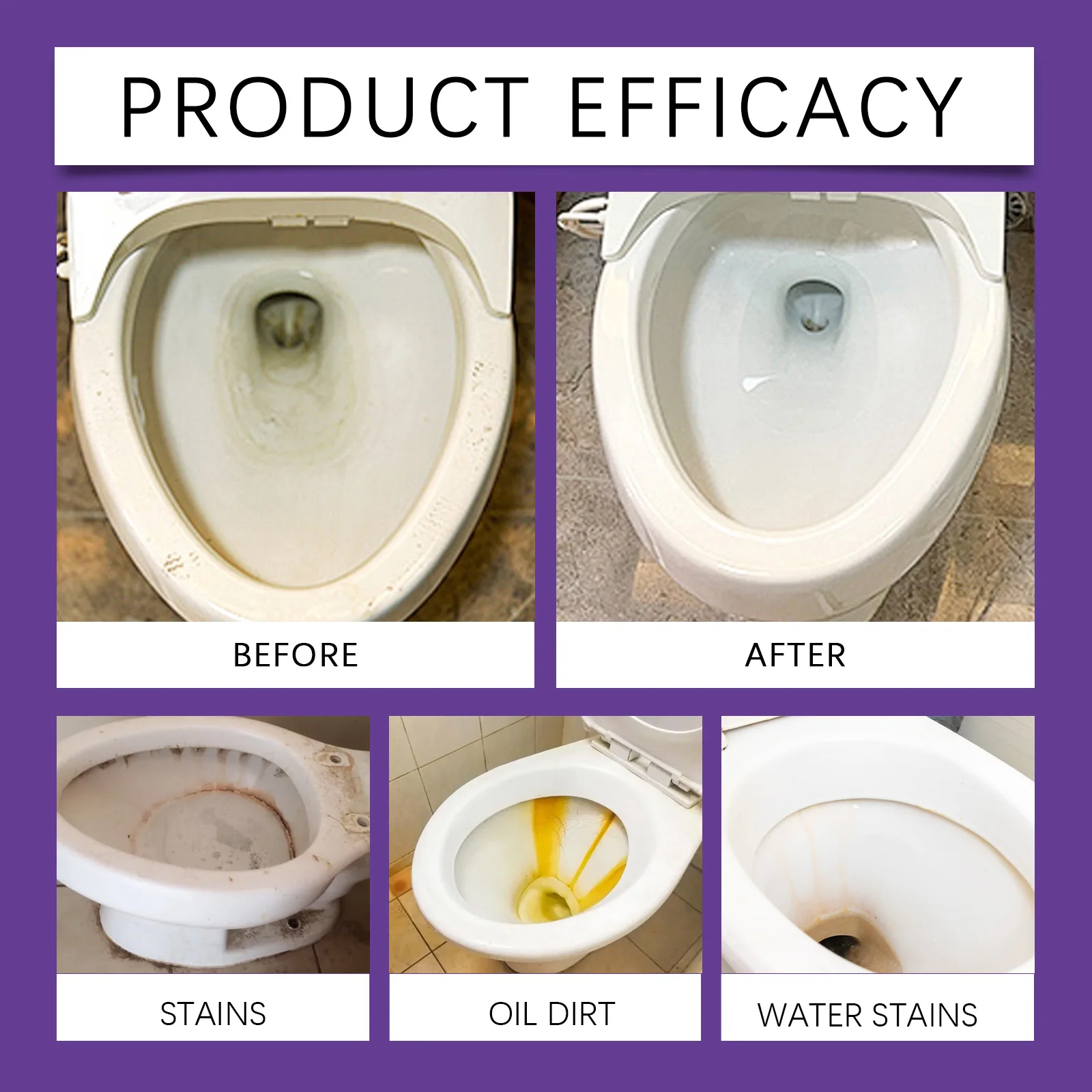 Thumbnail 2 - #16 Top 50 Toilet Bowl Cleaners Worth Buying In 2026
