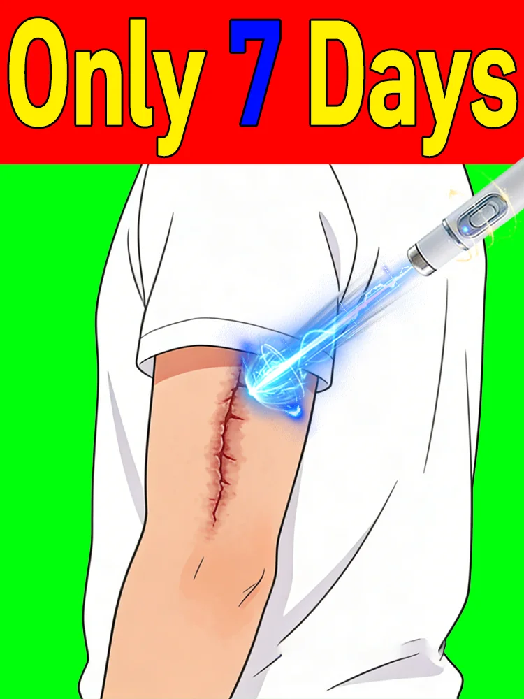 

Blue light pen Rᴇᴘᴀɪʀ Sᴄᴀʀꜱ. Rᴇꜱᴛᴏʀᴇ Sᴍᴏᴏᴛʜ Aɴᴅ Fʟᴀᴡʟᴇꜱꜱ Sᴋɪɴ