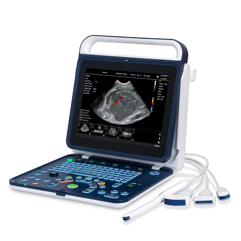 

Medical Ultrasound Instruments Portable Color Doppler Ultrasound Machine