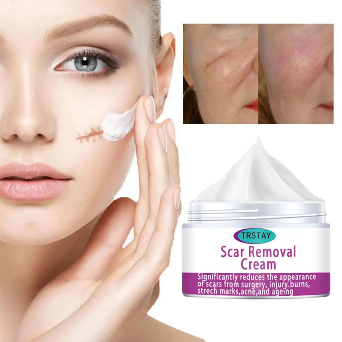 Repairing Scar Blackhead Shrink Pores  crema para manchas de la cara  crema aclaradora de piel