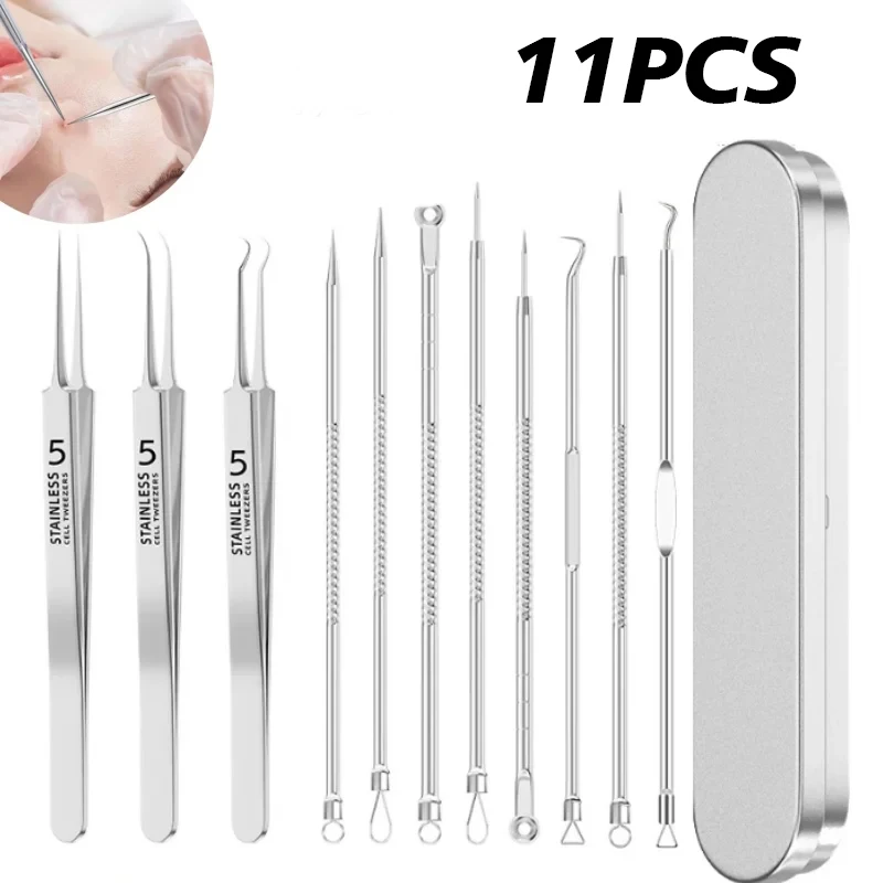 4-11 pz Strumenti per la cura della pelle del viso Acne Rimozione di punti neri Aghi Pinzette per capelli incarniti Punti neri Cleaner Detergente per pori Pulizia profonda