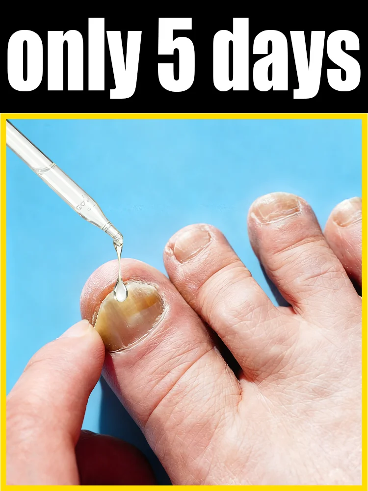 

Refreshing and non-irritating, small molecules deeply ⁿᵒᵘʳⁱˢʰ ᵃⁿᵈ ʳᵉᵖᵃⁱʳ ᵈᵃᵐᵃᵍᵉᵈ ⁿᵃⁱˡˢ