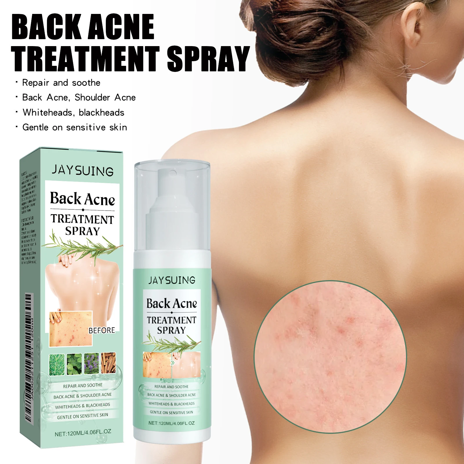 All-Natural Back Acne Repair Spray Smallpox Diluting Repair Back Shoulder Body Clean and Smooth Skin Moisturizes Protects Skin