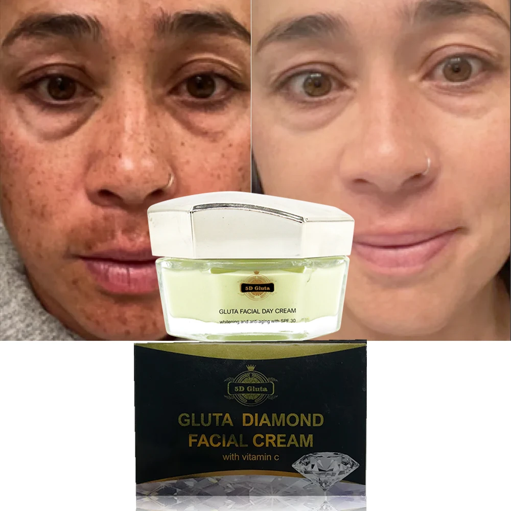 5D Gluta Diamond Face Care Cream Whitening Nourishing Moisturizes Brightens Skin for Dark Skin Female Beauty Day Cream