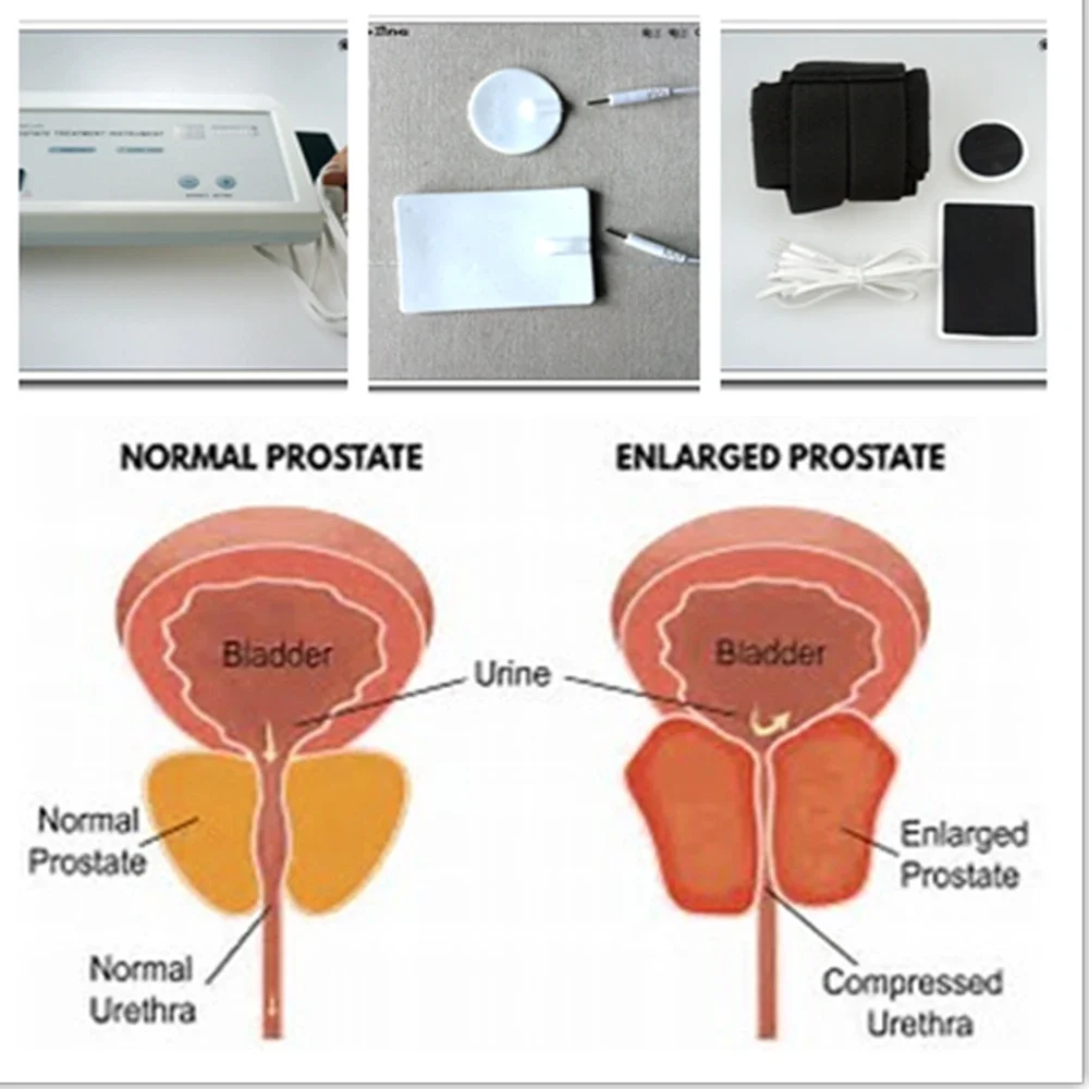 Powerful Prostate Massager Pulse Vibration Magnetic Therapy Instrument for Men Prostate Health Relaxation Home Wellness