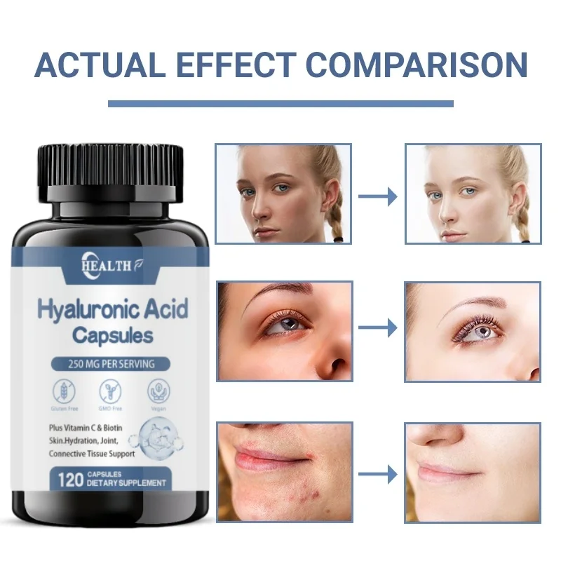 Hyaluronic Acid Capsules with Biotin & Vitamin C Improve Rough Skin Care, Joint Lubrication