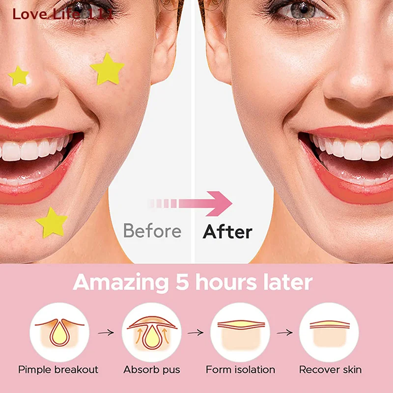 

Новинка, 456 шт., красочные пластыри со звездами и прыщами, красочные невидимые наклейки для удаления прыщей, уход за кожей, консилер, инструменты для макияжа пятен на лице