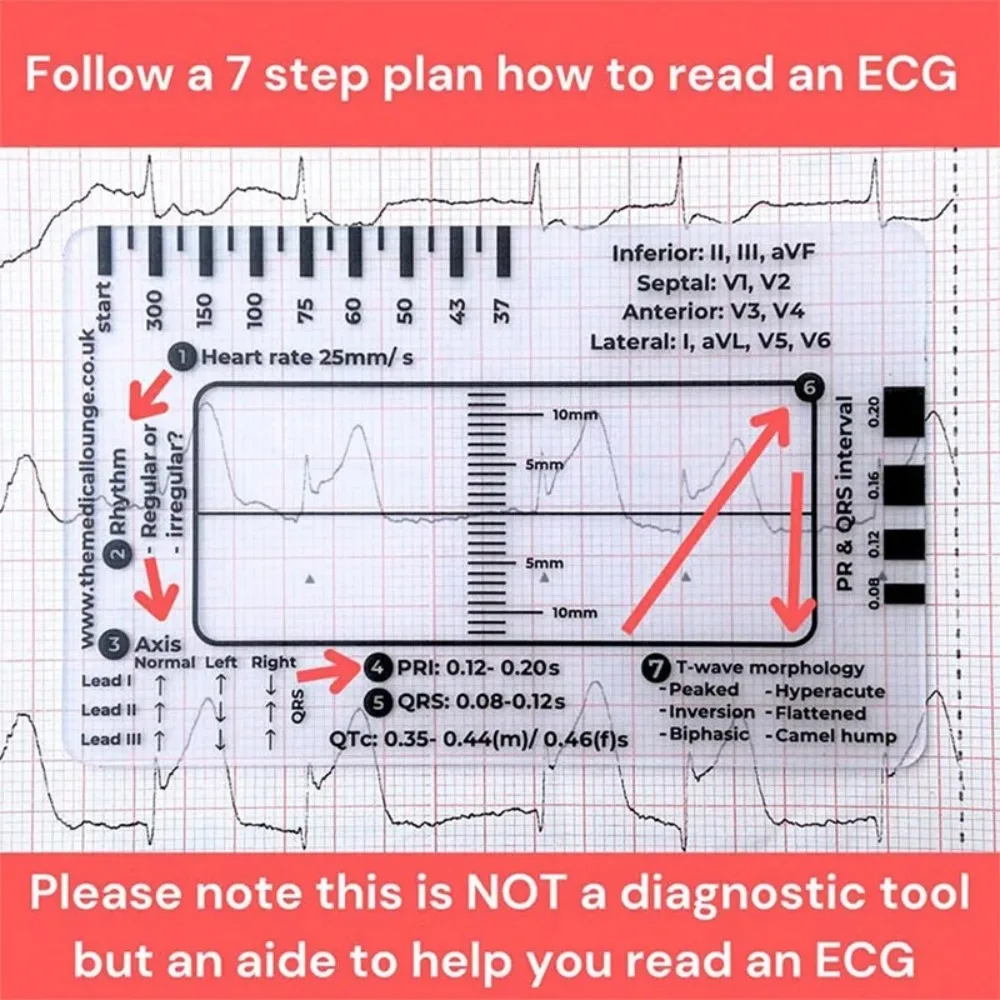 Interpretation ECG 7 Step Ruler Card Portable Pocket Clear ECG EKG Calipers Measure Tool with Protective Sheath